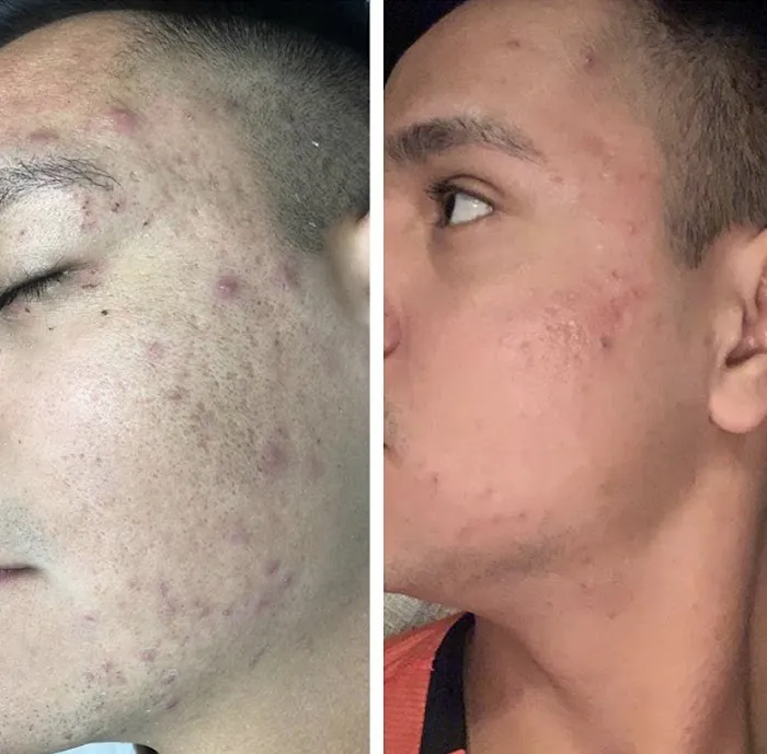 The Facial Room Picture 8