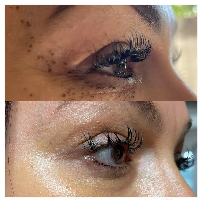 Magnolia Plasma Fibroblasting Picture 6