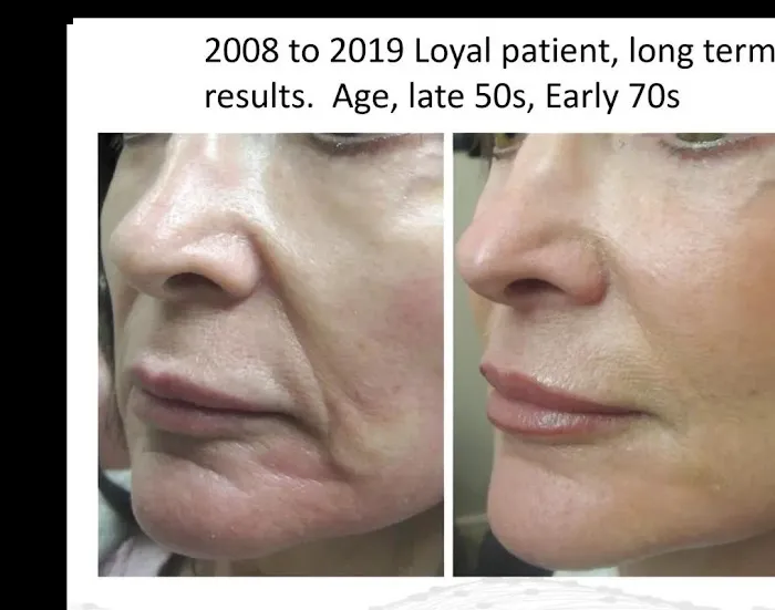 Oakley Aesthetics Picture 5