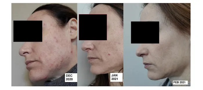 The Breakout Skin Clinic Picture 1