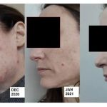 The Breakout Skin Clinic