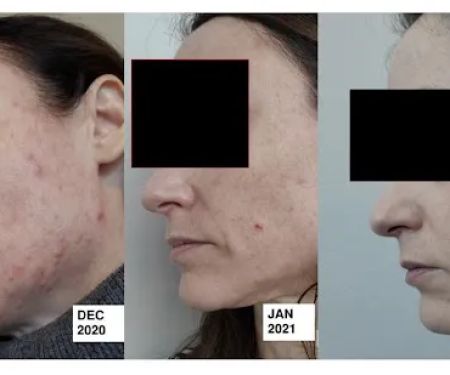 The Breakout Skin Clinic