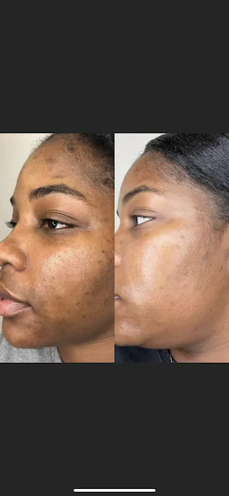 Heal Thy Skin DFW Picture 6