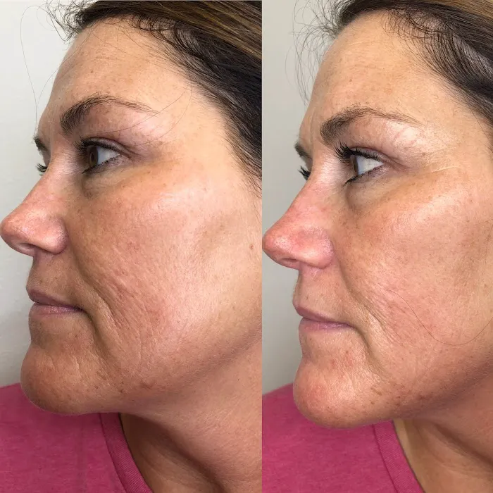 Heal Thy Skin DFW Picture 9