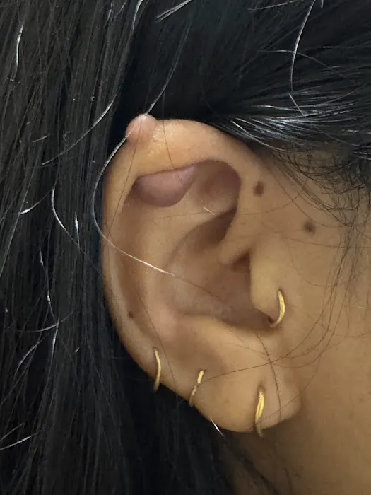 Star Dermatology Picture 8