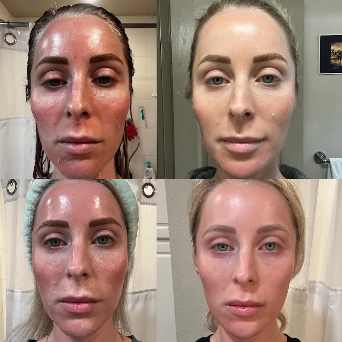 You Got Skin Picture 3