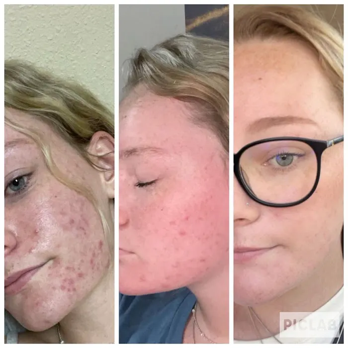 You Got Skin Picture 7