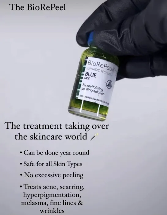 You Got Skin Picture 10