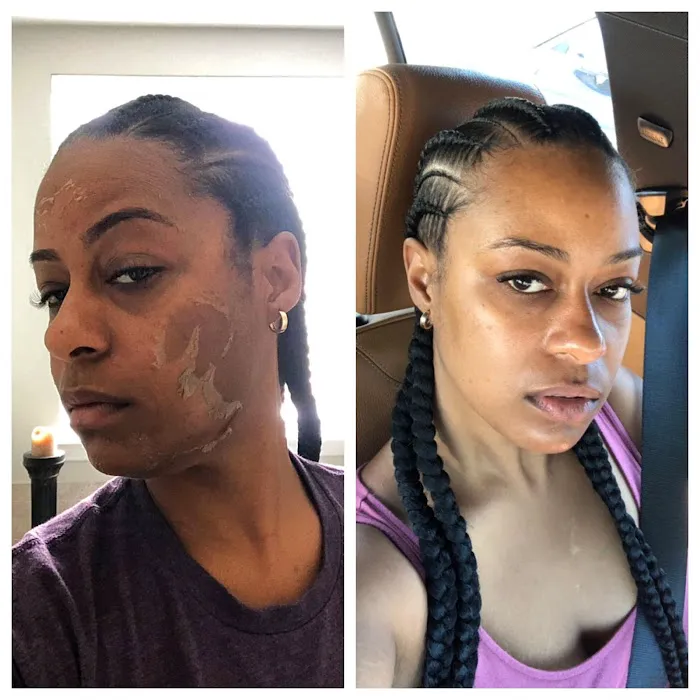 Rena Levi Skincare Picture 2