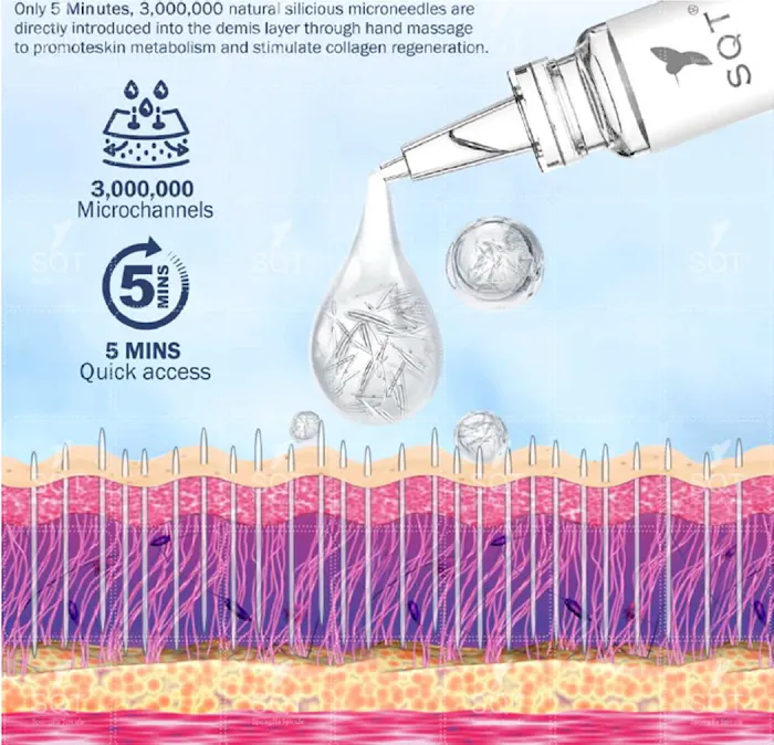 SQT Bioneedling Picture 6