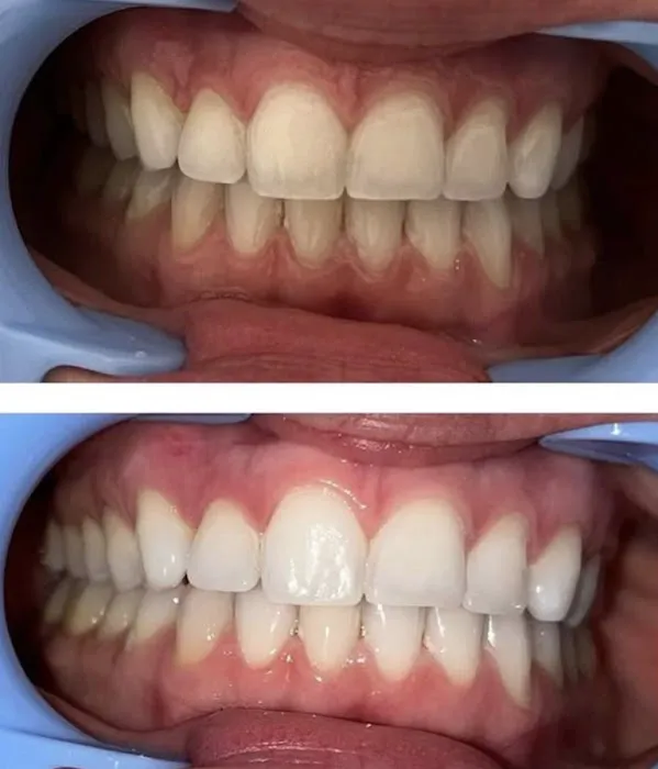 Arrglow Aesthetics Picture 3