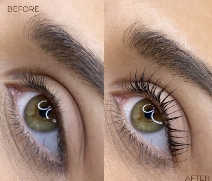 Arrglow Aesthetics Picture 10