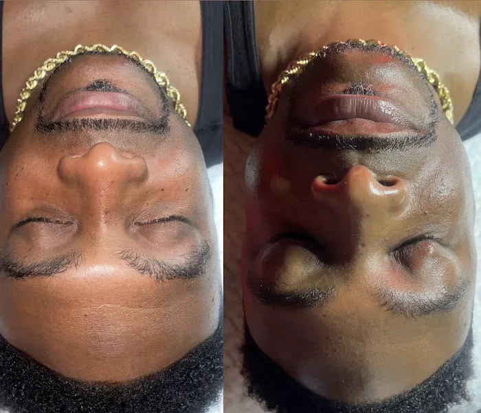 Arrglow Aesthetics Picture 9