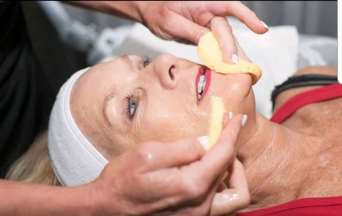 Flawless Skin Picture 7