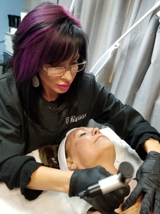 Flawless Skin Picture 10