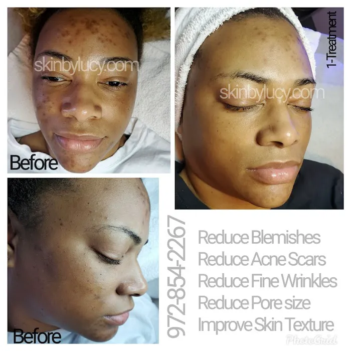 Skin by Lucy Med Spa Picture 5