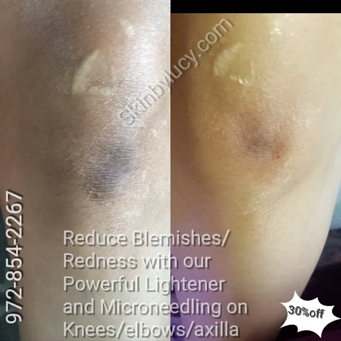 Skin by Lucy Med Spa Picture 7