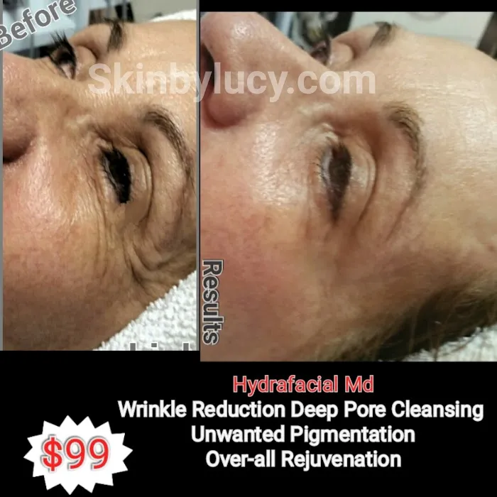 Skin by Lucy Med Spa Picture 6