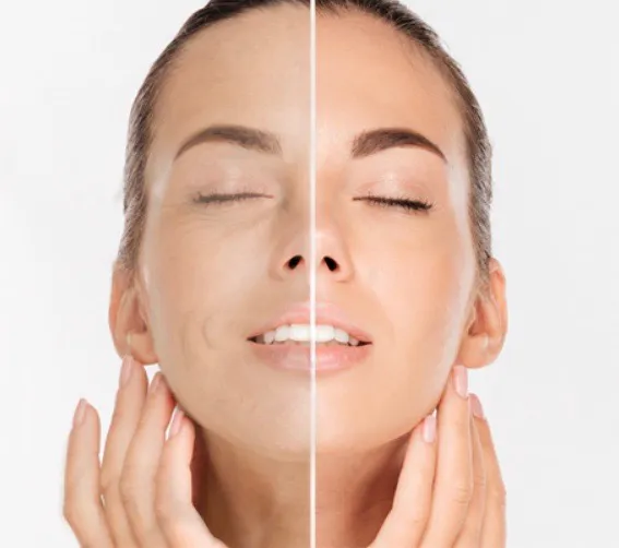 Esthetician Dallas | Facials, Chemical Peels, Microneedling - Urban Skin Care Picture 2