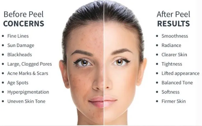 Esthetician Dallas | Facials, Chemical Peels, Microneedling - Urban Skin Care Picture 5