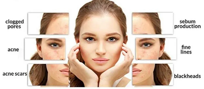 Esthetician Dallas | Facials, Chemical Peels, Microneedling - Urban Skin Care Picture 4