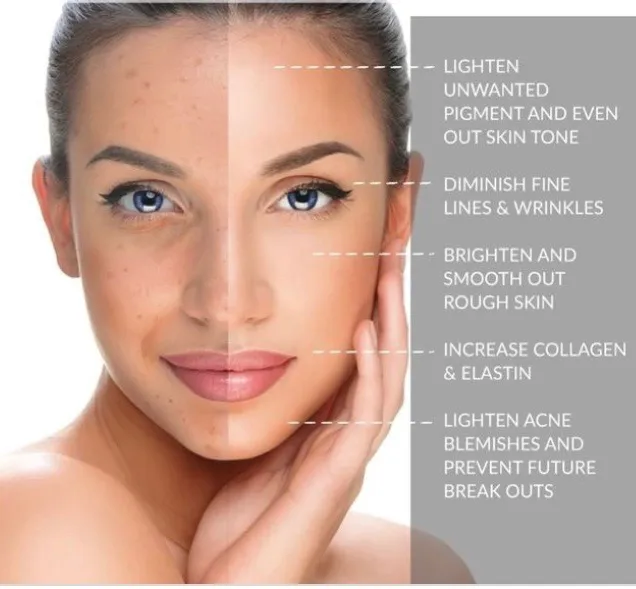 Esthetician Dallas | Facials, Chemical Peels, Microneedling - Urban Skin Care Picture 7