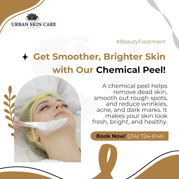 Esthetician Dallas | Facials, Chemical Peels, Microneedling - Urban Skin Care Picture 9