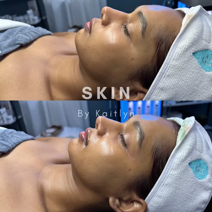 Skin By Kaitlyn LLC Picture 5