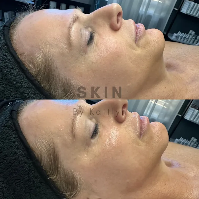 Skin By Kaitlyn LLC Picture 6