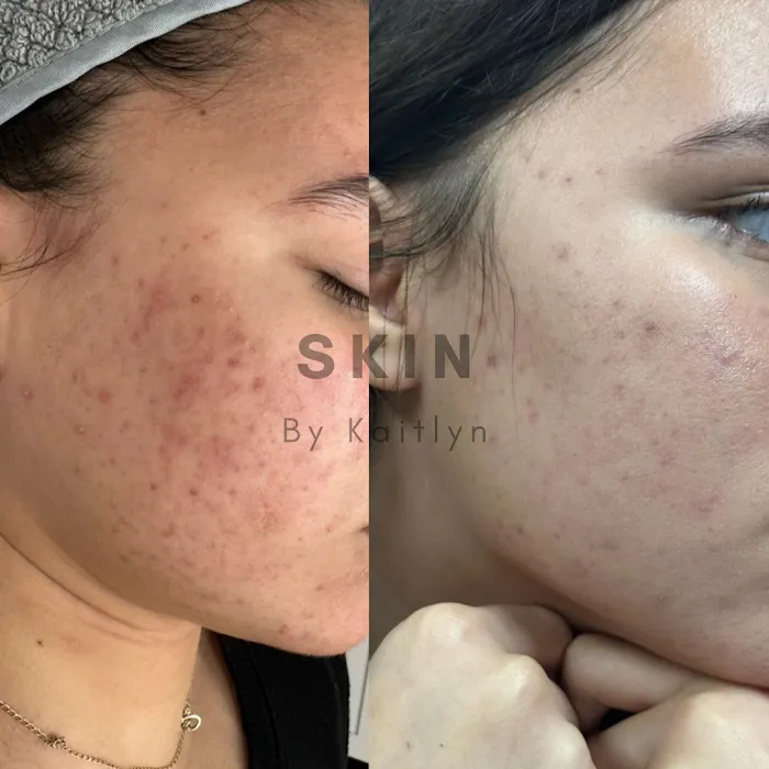 Skin By Kaitlyn LLC Picture 7