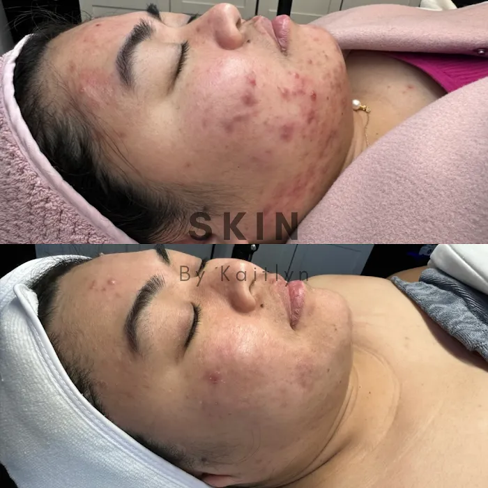 Skin By Kaitlyn LLC Picture 10