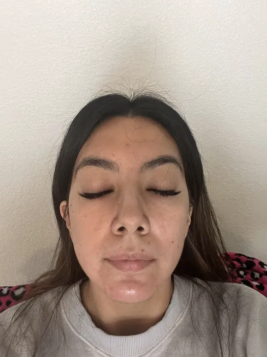 Everglow Acne & Skin Studio Picture 2