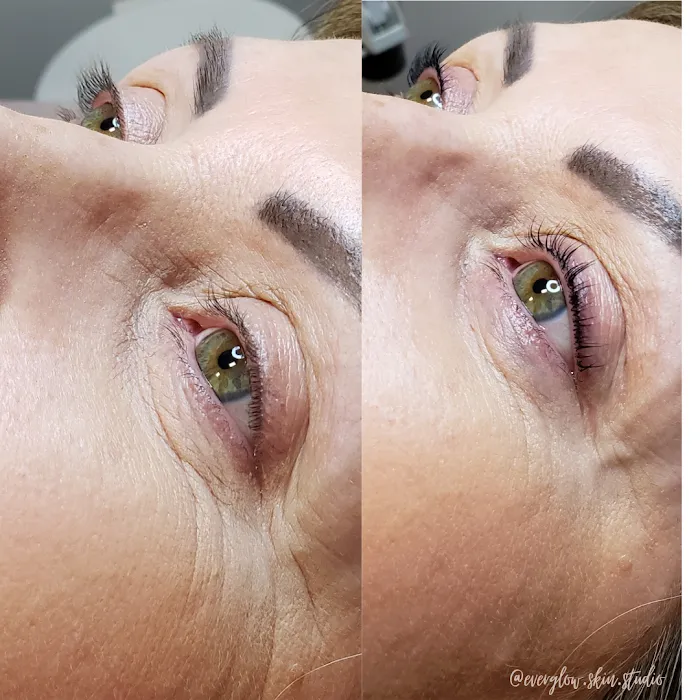 Everglow Acne & Skin Studio Picture 3