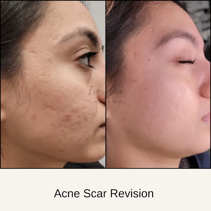 Everglow Acne & Skin Studio Picture 5