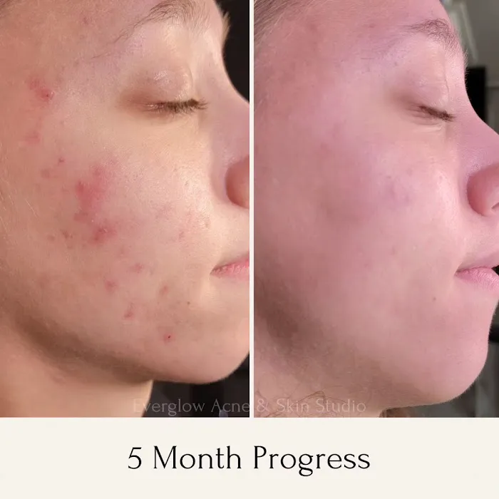 Everglow Acne & Skin Studio Picture 4