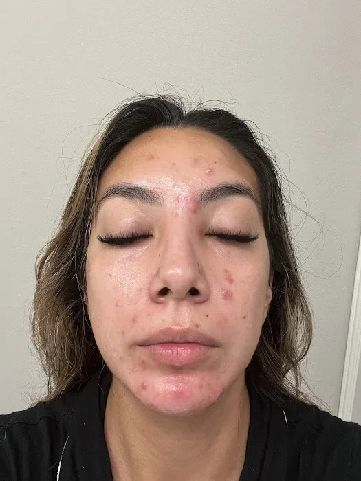 Everglow Acne & Skin Studio Picture 6