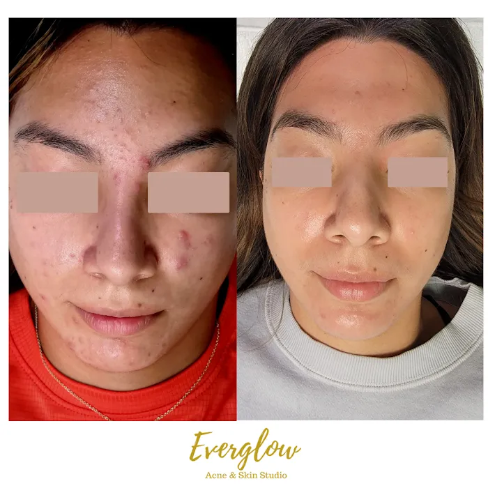 Everglow Acne & Skin Studio Picture 7