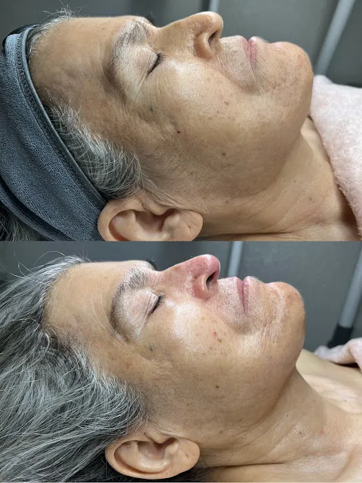 Alondra Aesthetics Picture 2