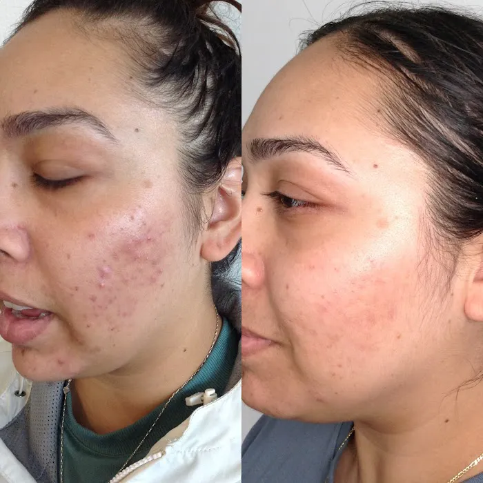 Skin Rituals Dallas Picture 2