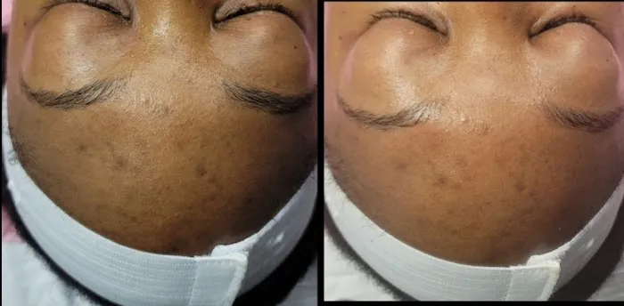 Sophisticated Skin Picture 1