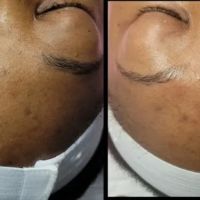 Sophisticated Skin ico