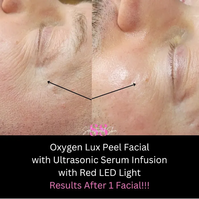 Sophisticated Skin Picture 4