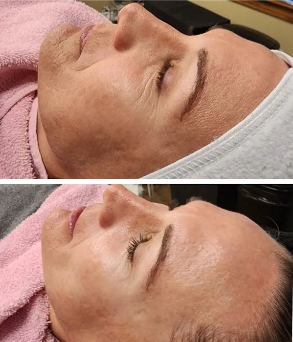 Sophisticated Skin Picture 2