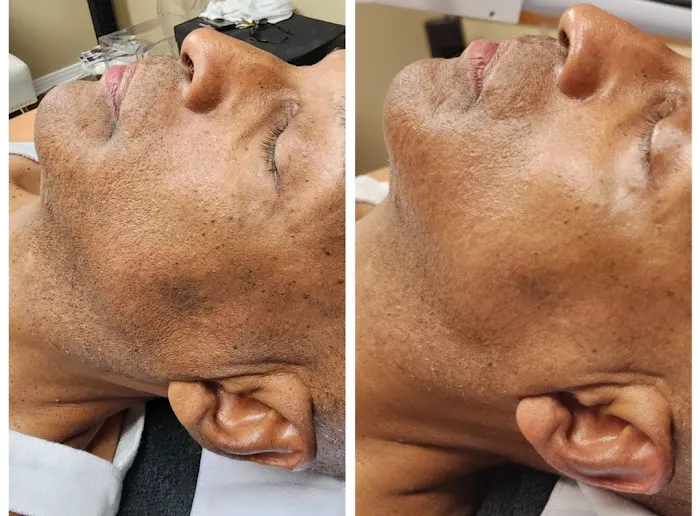 Sophisticated Skin Picture 5