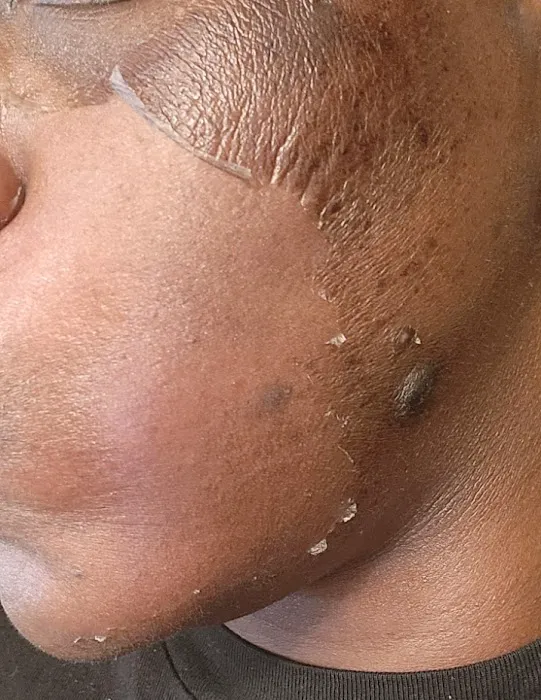 Sophisticated Skin Picture 8