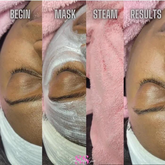 Sophisticated Skin Picture 7