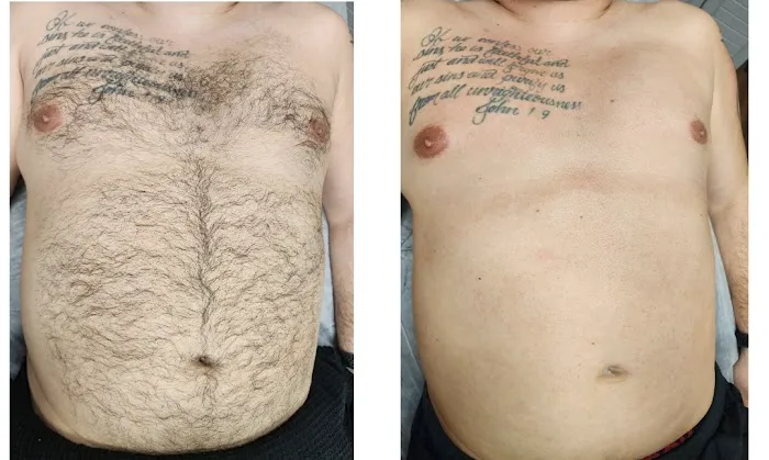 Sophisticated Skin Picture 10