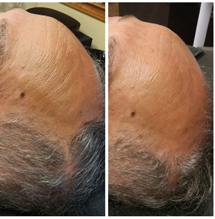 Sophisticated Skin Picture 9