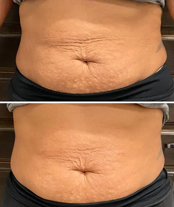 Bella Beautee Skin Picture 5