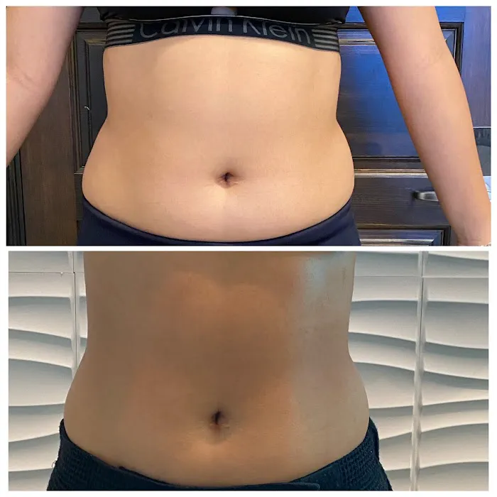 Bella Beautee Skin Picture 9